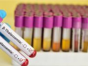 थेलेसिमिया रुग्णांसाठी मोफत तपासणी व निदान शिबिर