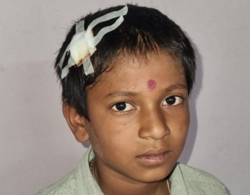 शिक्षकाने विद्यार्थ्यांचे डोके डेस्कवर आपटले डोक फुटल्याने विद्यार्थी झाला जख्मी .