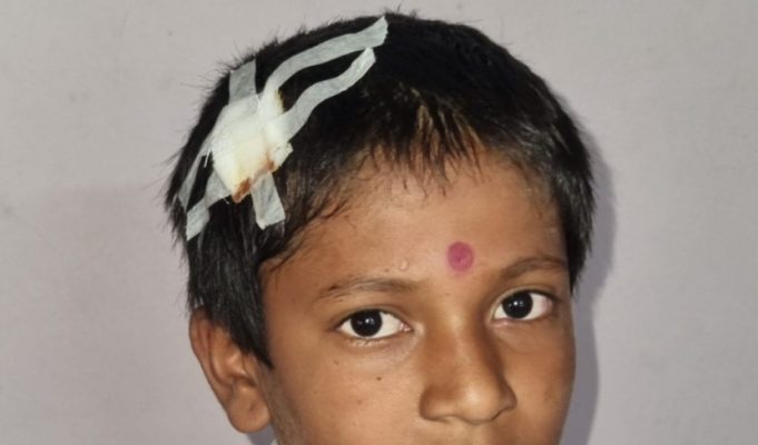 शिक्षकाने विद्यार्थ्यांचे डोके डेस्कवर आपटले डोक फुटल्याने विद्यार्थी झाला जख्मी .